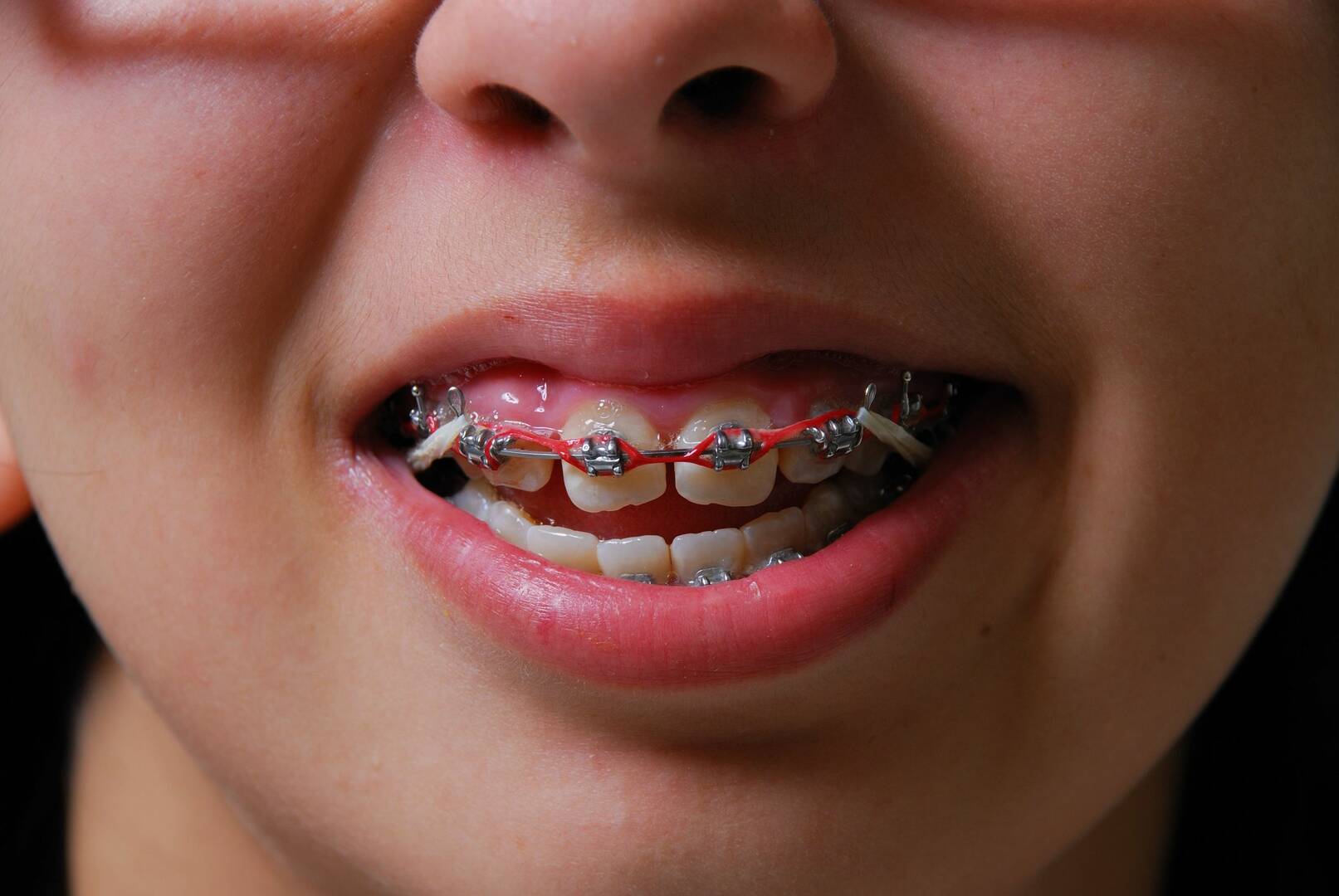 Smile Fresh Dental logo